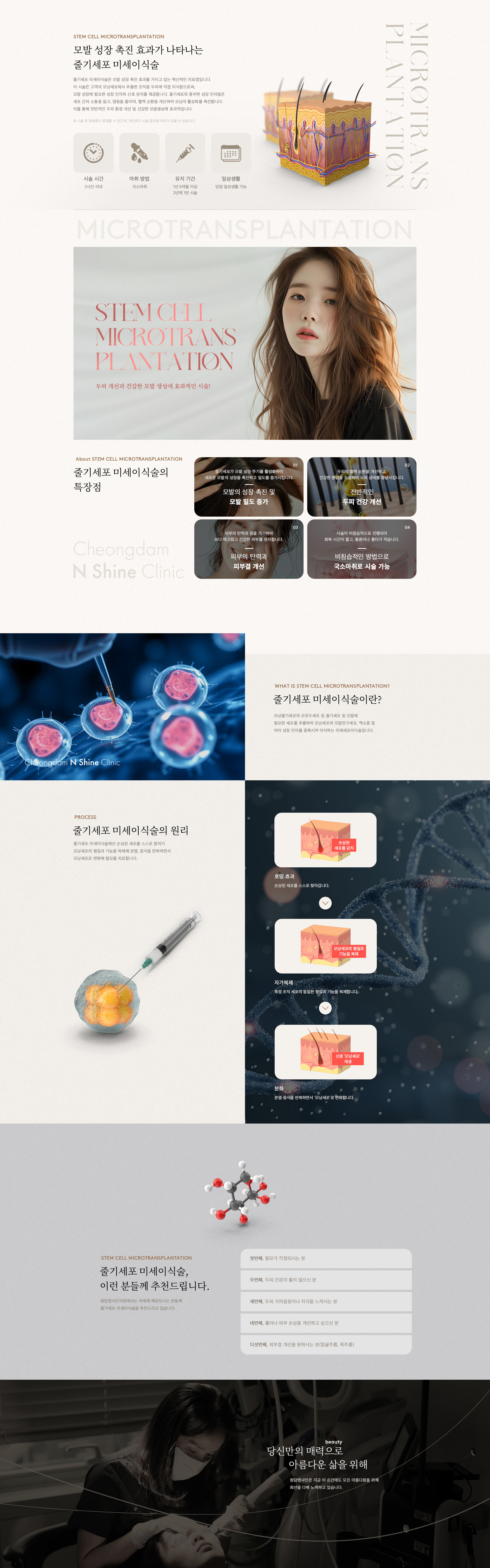 N Shine 줄기세포 미세이식술